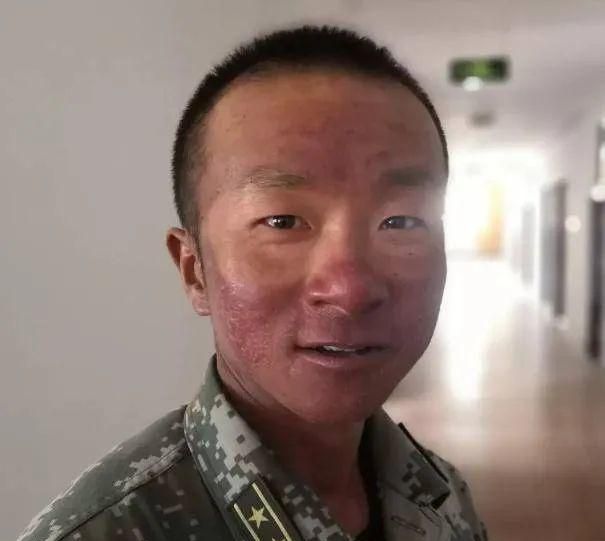 参加阅兵的战士脸上留下V字晒痕
